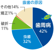 抜歯の原因：歯周病42％、虫歯32％、歯折11％、矯正1％、その他14％